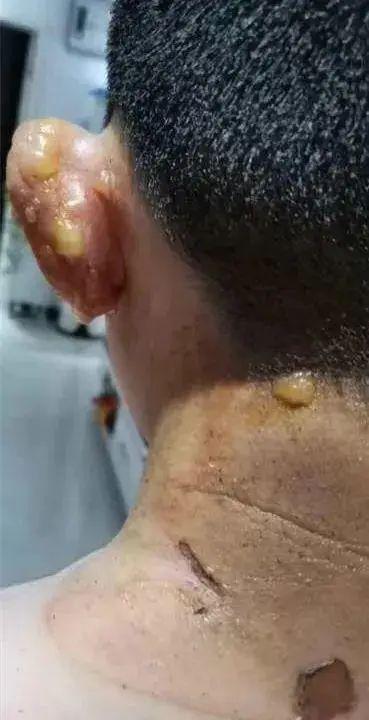 邯郸一小区爆料事件最新,业主维权引发关注，真相究竟如何？